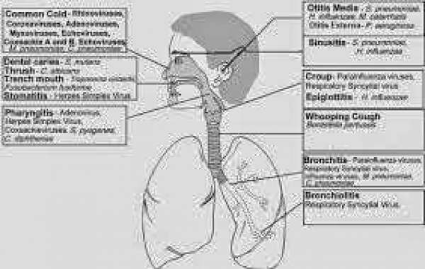 Respiratory tract infections (1) အသက်ရှူလမ်း ပိုးဝင်ခြင်း (၁)