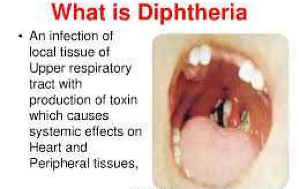 Diphtheria ဆုံဆို့ရောဂါ